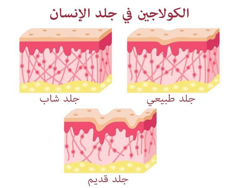 أعراض نقص الكولاجين في الجسم