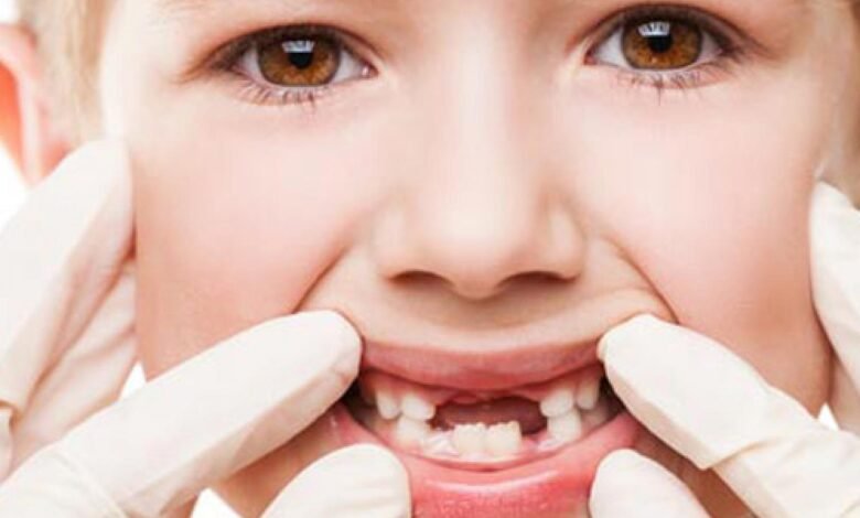 أسئلة وأجوبة عن الأسنان للأطفال