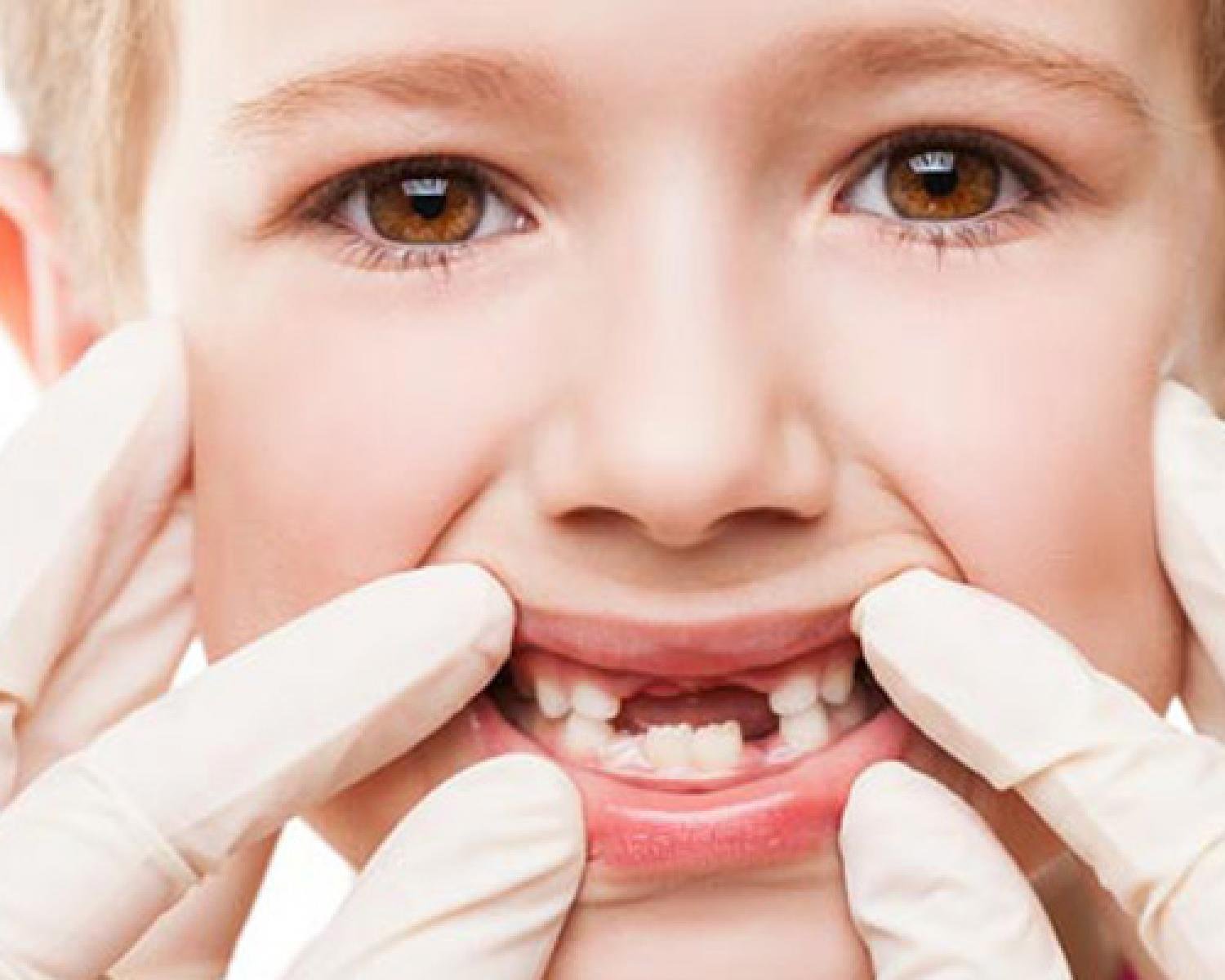 أسئلة وأجوبة عن الأسنان للأطفال