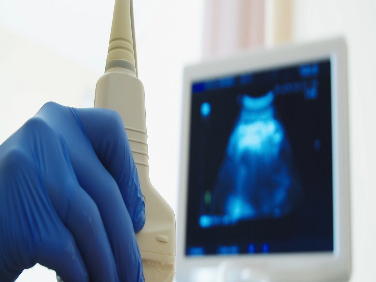 ما الوقت المناسب لإجراء أشعة 4D للحامل