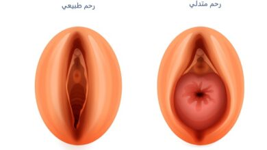 ما العلاقة بين هبوط الرحم والجماع؟