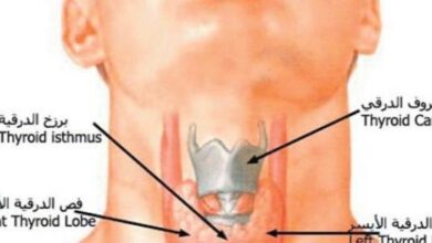 أين توجد الغدة الدرقية