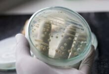 الفطريات المهبلية معدية للزوج