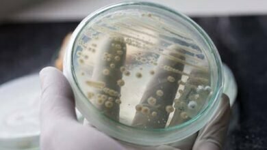 الفطريات المهبلية معدية للزوج