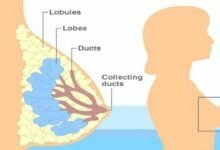 كم يوم يستمر احتقان الثدي بعد الفطام