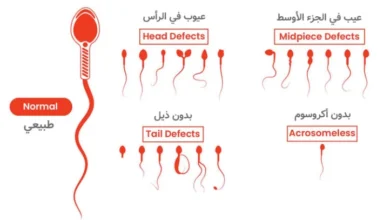 أسباب للعقم عند الرجال