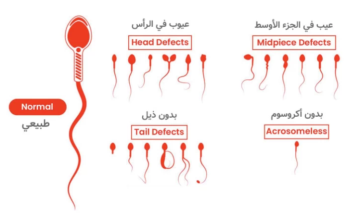 أسباب للعقم عند الرجال