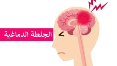 أعراض الجلطة الدماغية وكيفية التعامل معها