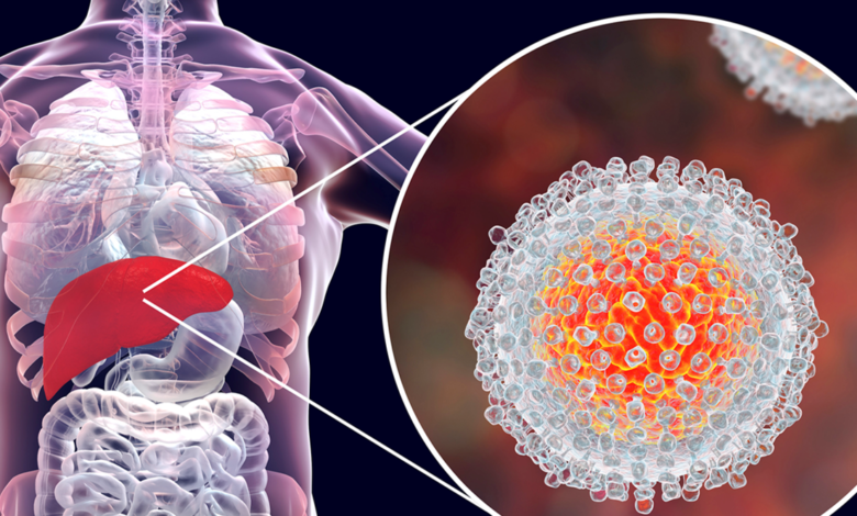 أنواع التهاب الكبد الفيروسي