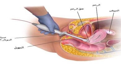 إجراء السونار المهبلي والسونار الخارجي