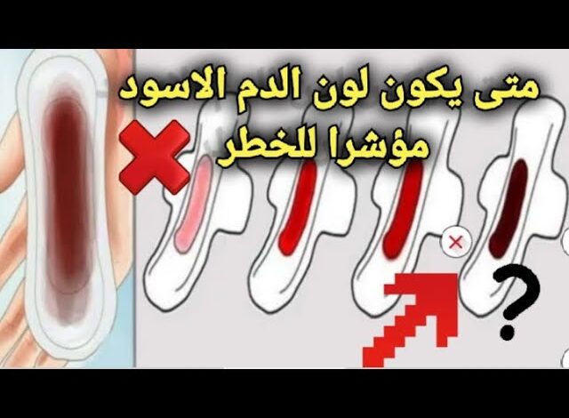 سبب نزول دم أسود بداية الدورة