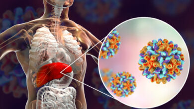 طرق علاج التهاب الكبد الفيروسي