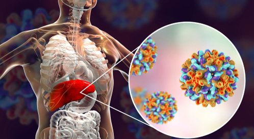 طرق علاج التهاب الكبد الفيروسي