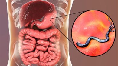 مضاعفات أدوية جرثومة المعدة