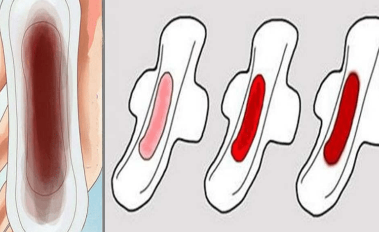 هل تلاحظين دم أسود ثقيل خلال دورتك الشهرية