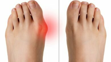 كيفية علاج الورم الملتهب لإصبع القدم بالمنزل