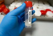 ما هو تحليل السائل المنوي الطبيعي؟