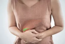 5 أسباب تضطرك لإجراء عملية المرارة