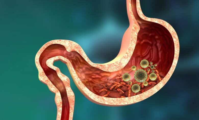 أسباب جرثومة المعدة